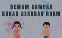 Demam Campak Bukan Sekadar Ruam